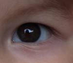 Прозрачные точки на границе радужки глаза у ребенка 1.8 фото 2