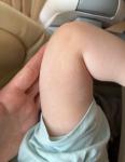 Светло-коричневое пятно на коже у ребенка фото 1
