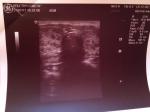 Вероятность беременности, расшифровка анализа на гормоны фото 1