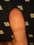 Волнистые ногти фото 1