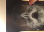 Рентген пазух в носа фото 1