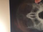 Рентген пазух в носа фото 3