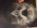 Рентген пазух в носа фото 2