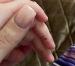 Пятно на пальце руки у ребенка фото 2