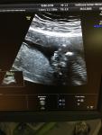 Пол ребенка на 16 недели беременности фото 2