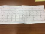 Расшифровка Кардиограммы и УЗИ сердца фото 4