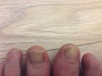 На ногтях появились белые пятна после ши-лака фото 1