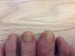 На ногтях появились белые пятна после ши-лака фото 2