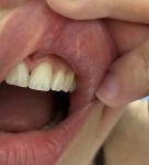 Слизистая рта и губ фото 1