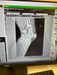 Болят колени, больно ходить, посмотрите рентген пожалуйста фото 2