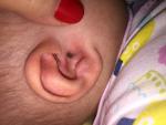 Разные дырочки в ушной раковине у ребенка фото 2