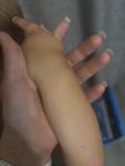 Сыпь на теле у ребенка, что может и чем лечить? фото 2