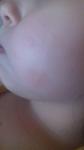Розовые пятна на щеках у ребенка фото 1