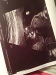 Пол ребенка на 16 недели беременности фото 1