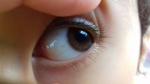 Пятна на глазном белке у девочки 3.5 года фото 1