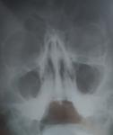 Рентген пазух на ввк фото 1