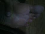 Болезнь ступней ног фото 1