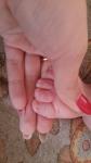 Нарост впритык к ногтям больших пальцев на ногах ребенка фото 3