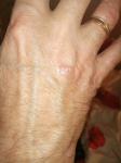 Шелушащейся сухое пятно на руке фото 2
