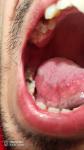 Болит язык и горло фото 1