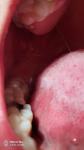 Болит язык и горло фото 2