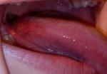 Болит язык и горло фото 2