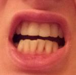 Кривые зубы фото 2