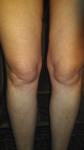 Болит правая нога от бедра до колена фото 4