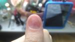 Проблемы с ногтями фото 3