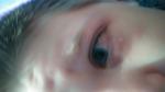Покраснение глаз у ребенка во время простуды фото 1
