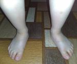 Ровные ли ножки у ребенка 3 года? фото 4