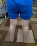 Ровные ли ножки у ребенка 3 года? фото 2