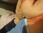 Сыпь на горле ребёнка фото 3