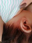 Сыпь у ребенка за ухом и подбородком фото 1