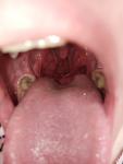 Опух язык с внутренней стороны фото 1