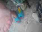 Опух палец у ребенка на ноге, сильная боль и кривой фото 1