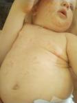 Сыпь у ребенка в 9 месяцев не проходит фото 2