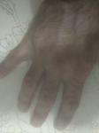 Болят суставы пальцев правой руки фото 1