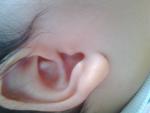 Шишка на внутренней стороне уха у ребенка 3 месяца фото 1