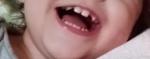 Отсутствие зубов у ребенка в 2 года фото 1