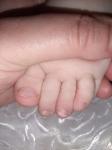 Слоение ногтей ног у ребёнка фото 1