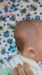 Плоский затылок у ребёнка в 4 месяца фото 2
