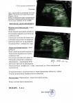 Подозрение на рак молочной железы фото 2