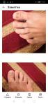 Потемнели ногти на больших пальцах ног фото 1