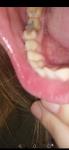 Зуб. Десна фото 1