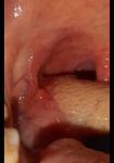 Болит горло и язык фото 4