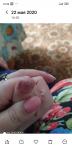 Трещины на пальце у ребенка фото 3