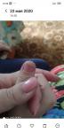 Трещины на пальце у ребенка фото 2
