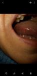 Болит язык, лимфоузлы фото 1