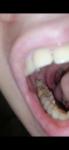 Болит кость основания зуба фото 1
